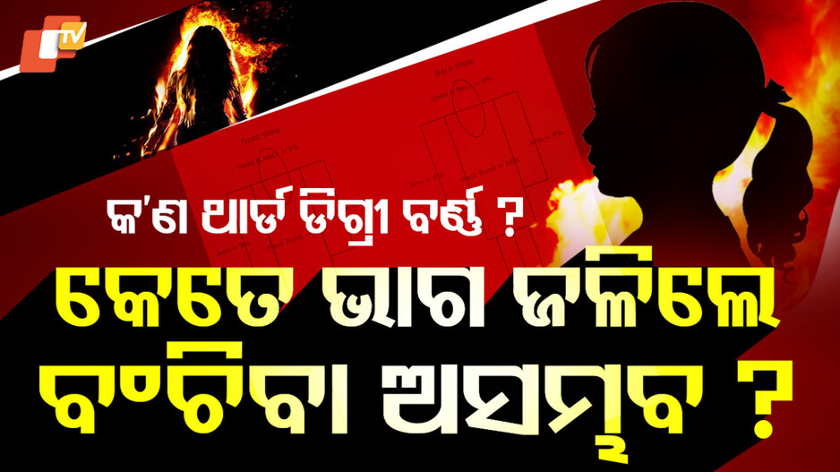 burn:-କେତେ-ପ୍ରକାର-ଜଳାପୋଡ଼ା,-କେତେ-ମାତ୍ରାରେ-ଜଳିଲେ-ମଣିଷର-ମୃତ୍ୟୁ-ହୋଇଥାଏ-ଜାଣନ୍ତୁ