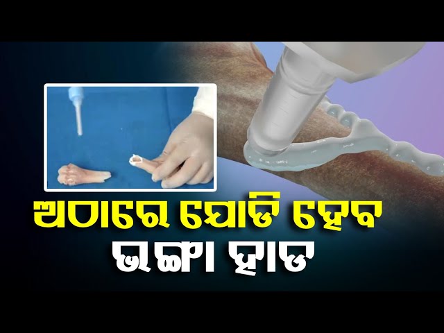 ମାତ୍ର୨-୩-ମିନିଟ୍-ଲାଗିବ-ସମୟଅସ୍ତ୍ରୋପଚାର-ହେବ-ଆହୁରି-ସହଜଚୀନ୍-ବୈଜ୍ଞାନିକଙ୍କ-ଅଦ୍ଭୁତପୂର୍ବ-ସଫଳତା-||knews-odisha