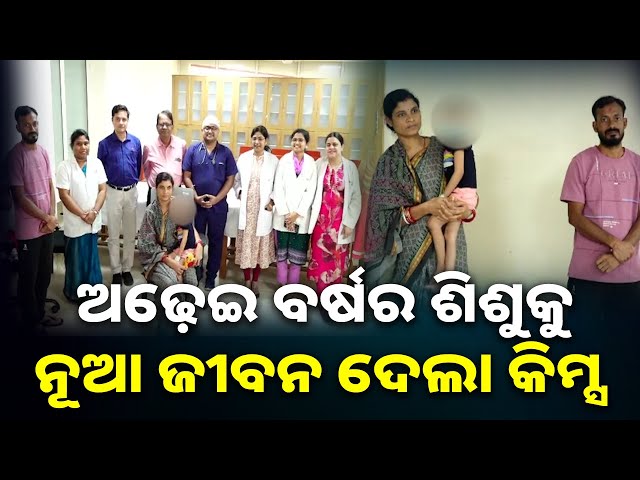 ଓଡିଶାରେ-ପ୍ରଥମ-ଥର-ପାଇଁ-କିମ୍ସ-କଲା-ଜଟିଳ-ଯକୃତ-ଅସ୍ତ୍ରୋପଚାର,-୭-ବିଭାଗର-୧୫-ଡାକ୍ତର-ଶିଶୁକୁ-ଦେଲେ-ନୂଆ-ଜୀବନ