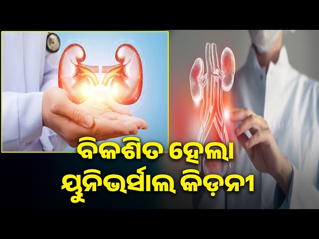 କିଡନୀ-ପ୍ରତିରୋପଣ-ପାଇଁ-ଆଉ-ଆବଶ୍ୟକ-ନାହିଁ-ବ୍ଲଡ଼-ଗ୍ରୁପ-ମ୍ୟାଚ୍,-ସମସ୍ତଙ୍କ-ଶରୀରରେ-ଲାଗିପାରିବ-ଏ-କିଡନୀ