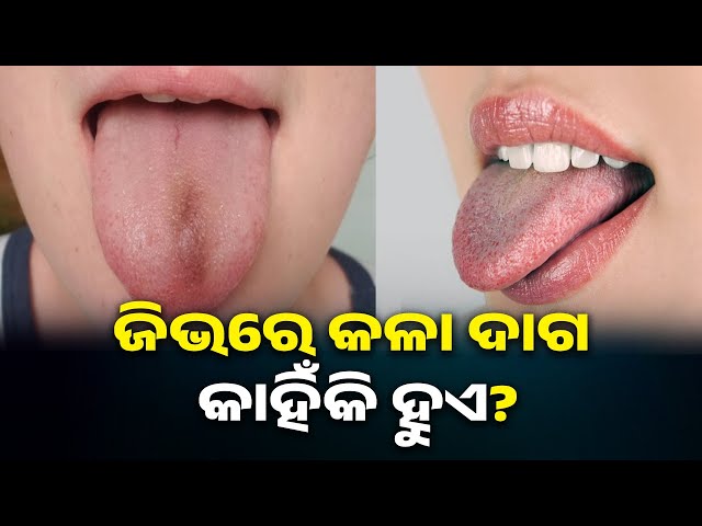 ଘରୋଇ-ଉପାୟ-ଆପଣେଇ-ଦୂର-କରନ୍ତୁ-ଏହି-ସମସ୍ୟା,-ମିଳିବ-ଫାଇଦା-||-knews-odisha