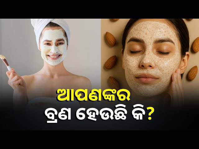 ନିଜ-ଖାଇବା-ଲିଷ୍ଟରେ-ସାମିଲ-କରନ୍ତୁ-ଏହି-ସବୁ-ଖାଦ୍ୟ,ତ୍ଵଚାରେ-ଚମକ୍-ଆଣିବା-ସହ-ବ୍ରଣ-ସମସ୍ୟାକୁ-କରିବ-ଦୂର