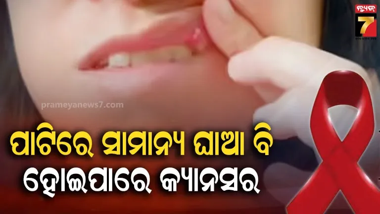ମୁହଁରେ-ହେଉଥିବା-ଛୋଟମୋଟ-ପରିବର୍ତ୍ତନକୁ-କରନ୍ତୁନି-ଅଣଦେଖା,-ସାଧାରଣ-ଫୋଟକା-ବି-ହୋଇପାରେ-କର୍କଟ