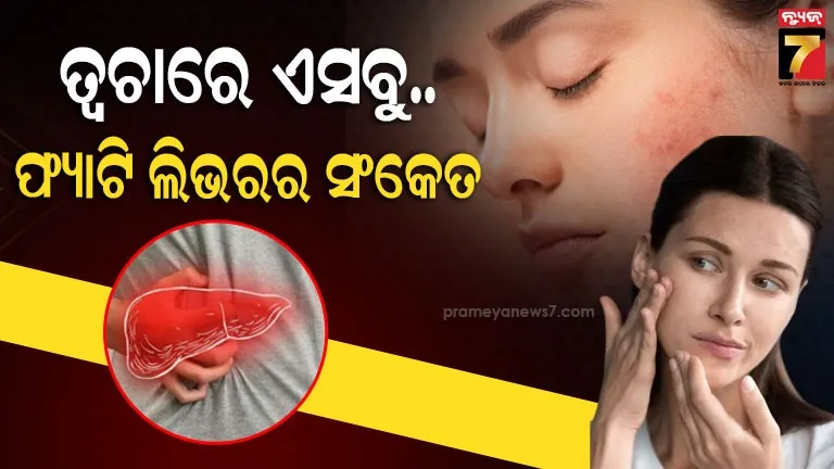 fatty-liver-warning:-ମୁହଁରେ-ଦେଖାଯାଉଥିବା-ଏହି-୩-ସଂକେତକୁ-କରନ୍ତୁନି-ଆଣଦେଖା-,-ନହେଲେ-ବଢ଼ିପାରେ-ଫ୍ୟାଟି-ଲିଭର-ବିପଦ