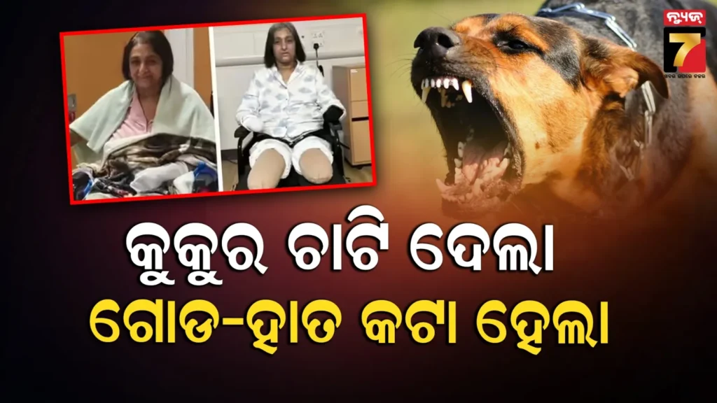 ପୋଷା-କୁକୁର-ହେଲା-କି-ଘାତକ!-ଭୟଙ୍କର-‘ସେପସିସ୍’-ରେ-ଆକ୍ରାନ୍ତ-ଭାରତୀୟ-ମହିଳାଙ୍କ-ହାତ-ଗୋଡ-କଟା-ହେଲା