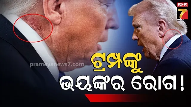 ଆମେରିକା-ରାଷ୍ଟ୍ରପତିଙ୍କୁ-ଅଚାନକ-ହେଲା-କଣ?-କାନ-ତଳେ-ଏମିତି-ସ୍ପଟ୍,-ସାରା-ବିଶ୍ୱ-ଚକିତ…